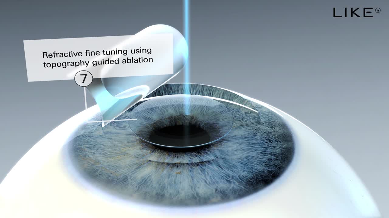 LIKE Procedure - 3D Animation - Eyetube
