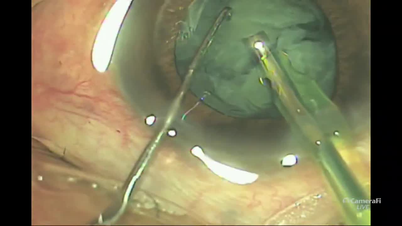 Submarine Chop