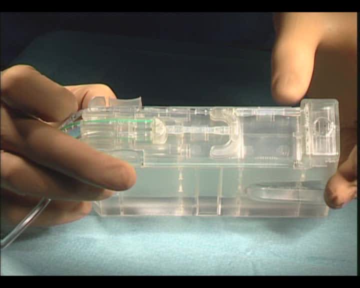  Fluidics Management in MICS
