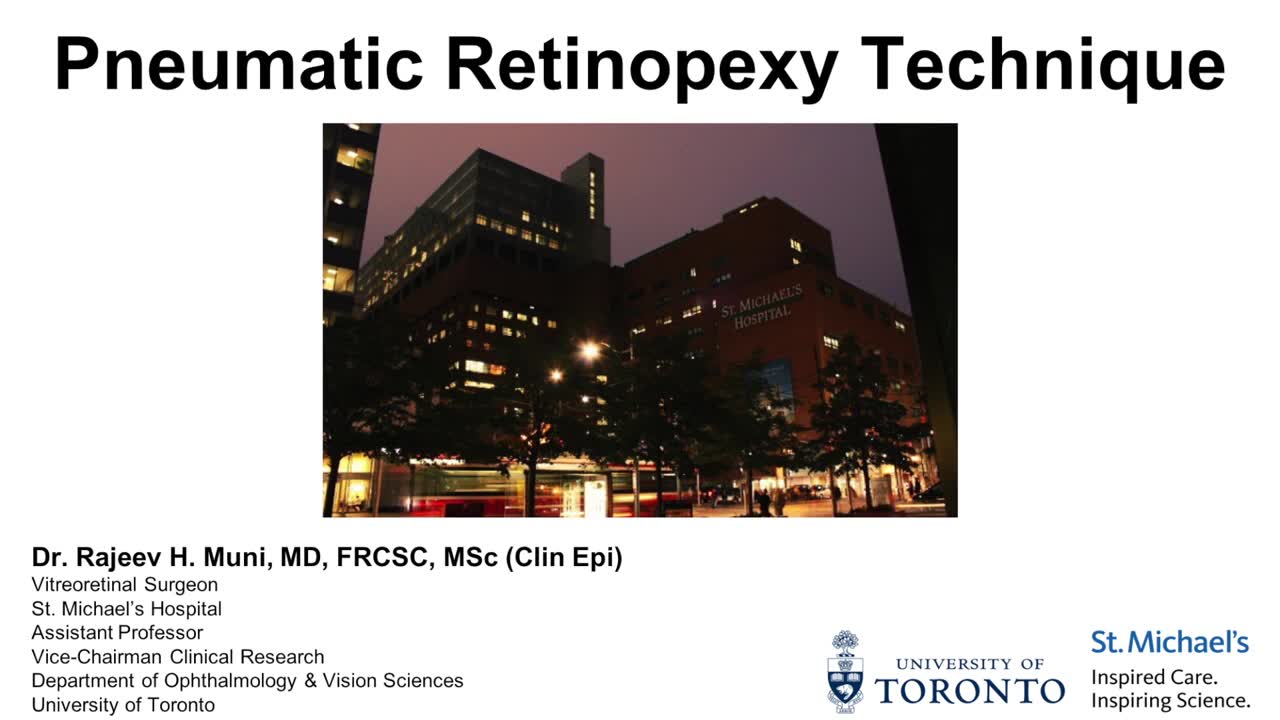 Pneumatic Retinopexy for Rhegmatogenous Retinal Detachment
