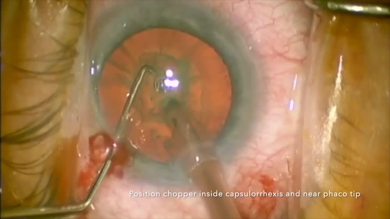 Understanding Vertical Chop