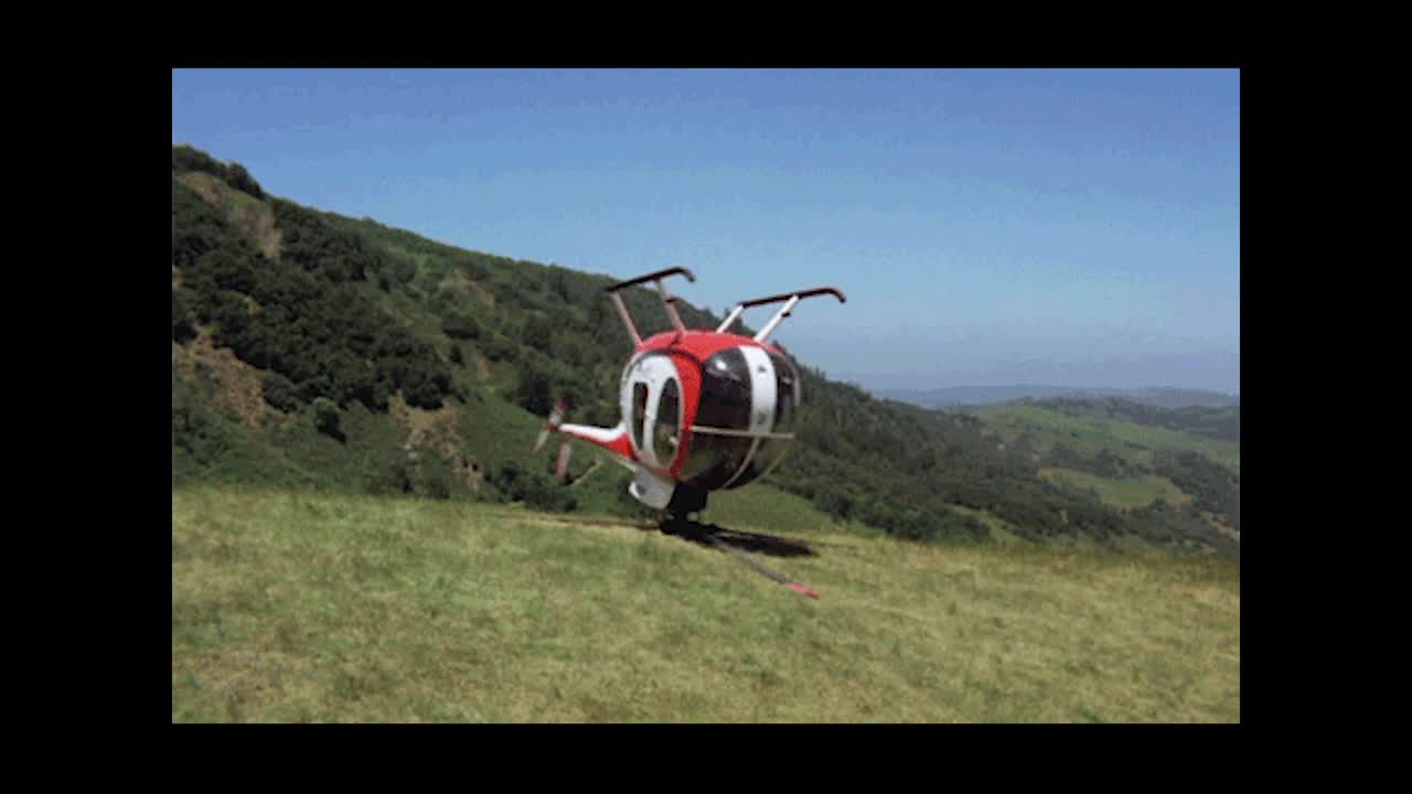 Double Peel of ERM and ILM for Adherent ERMs With Brilliant Blue Technique