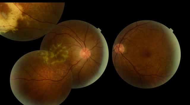 The Blind Eye and the Invisible Guest