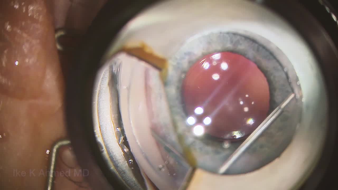 Xen Implantation: Expert Principles Tutorial