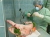 Phaco Follies II