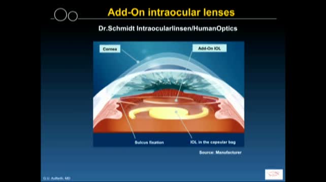 HumanOptics/Dr. Schmidt (Add-On)