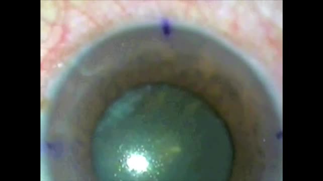 Iris Misbehavior