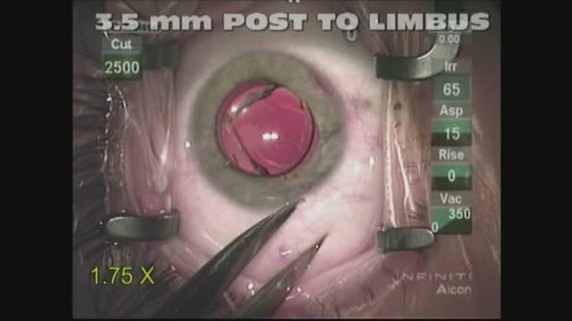 Haptic Amputation