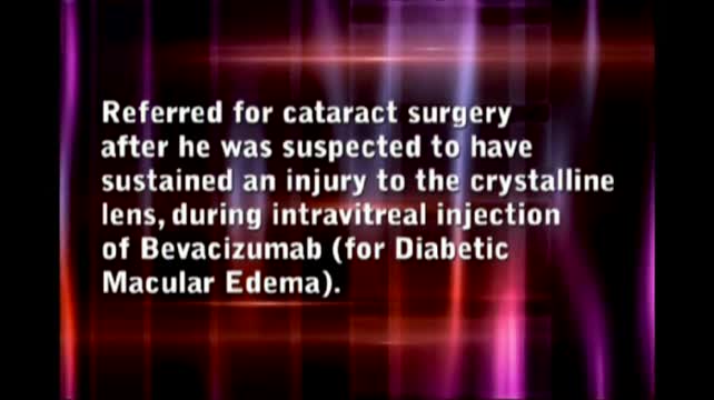 Avastin Capsular Damage