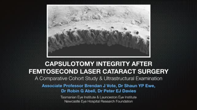 Capsulotomy Integrity after Femtosecond Laser Cataract Surgery 