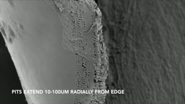 Comparative Review of Capsular Integrity After Femtosecond Laser Cataract Surgery
