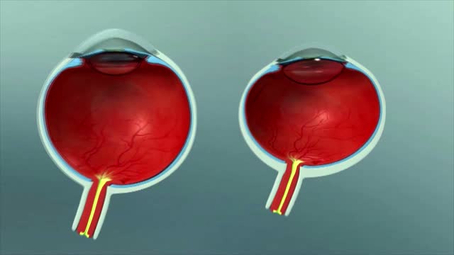Thumbnail for vj366