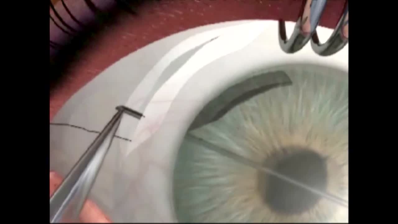 Sewing Machine Technique
