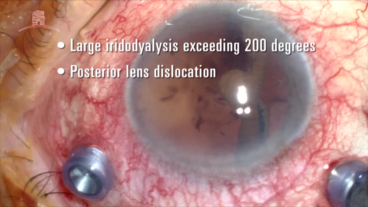 Triple Procedure
