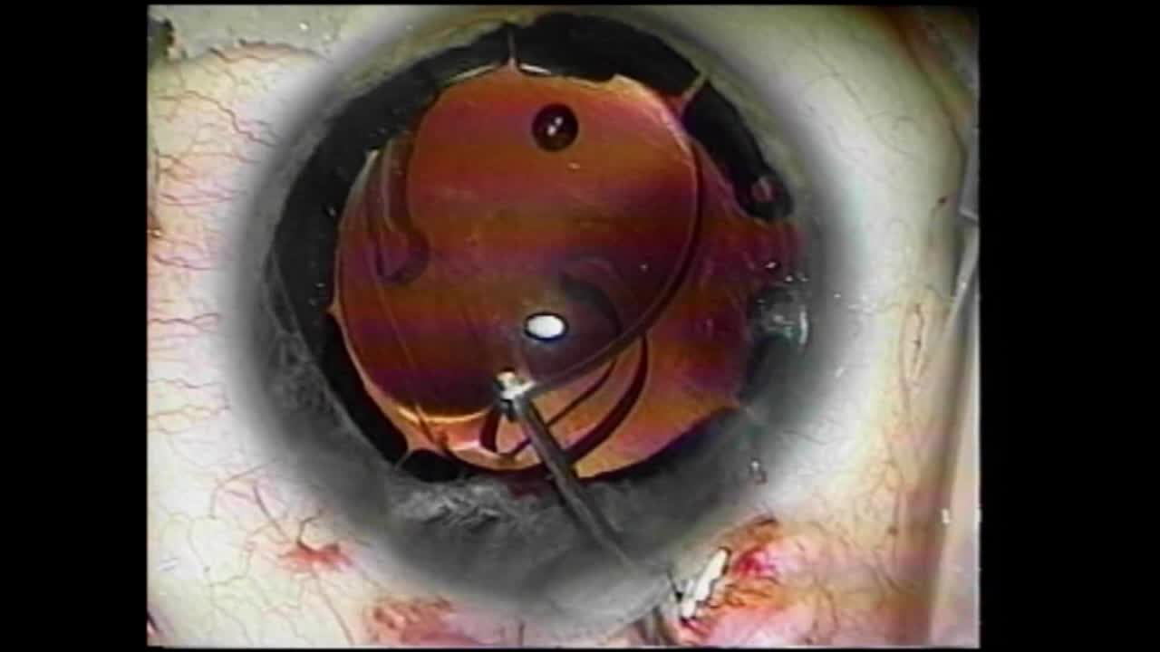 Iatrogenic Disaster and Repair