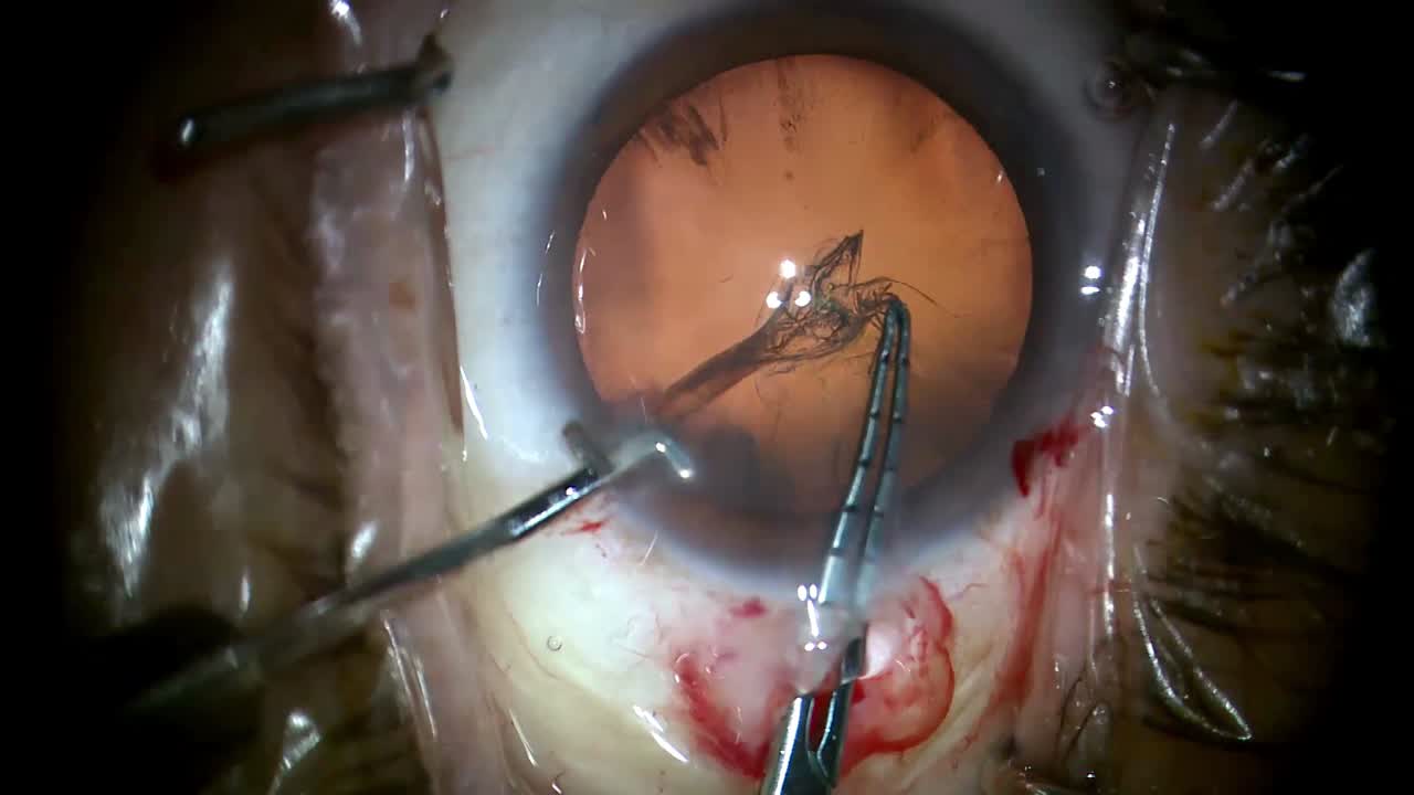 Routine Case Performed By Gregory Ogawa, MD