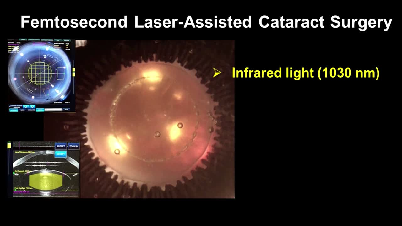 Principles of Refractive Index Shaping of IOLs with Femtosecond Laser
