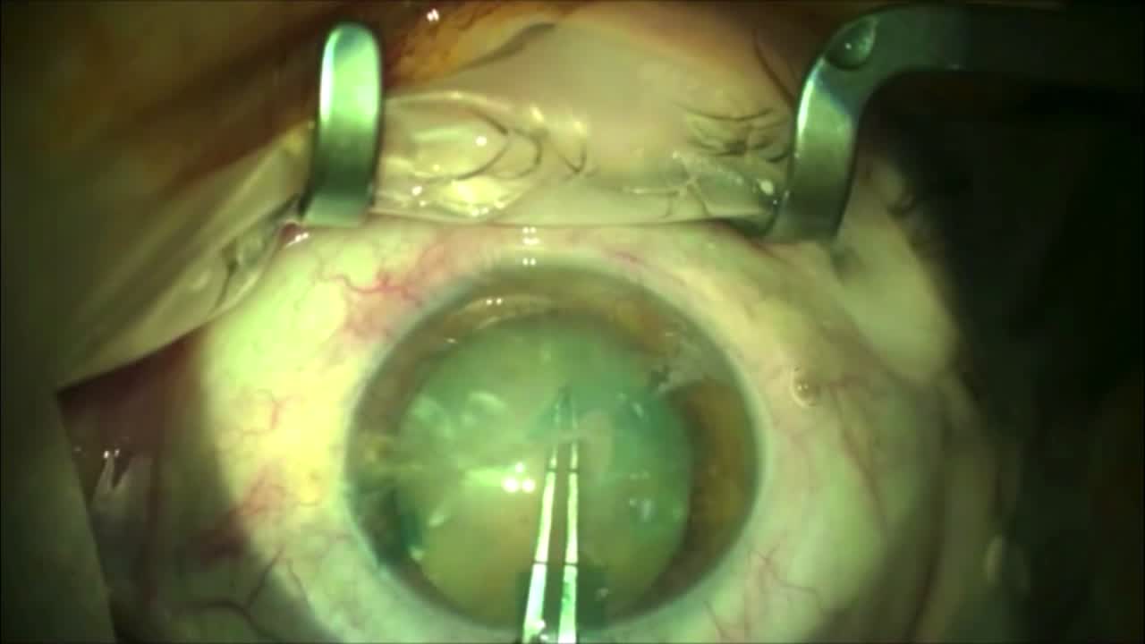 Small Eye . . . Big Problem