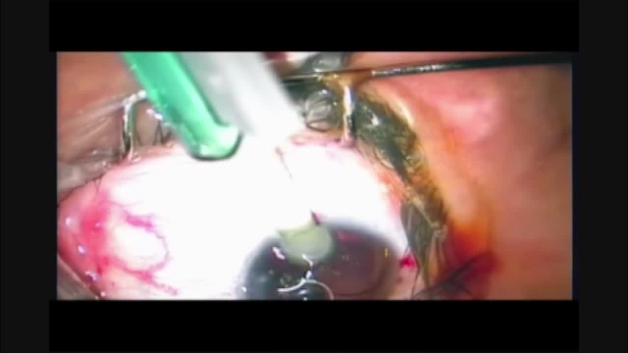 Injecting the Injector