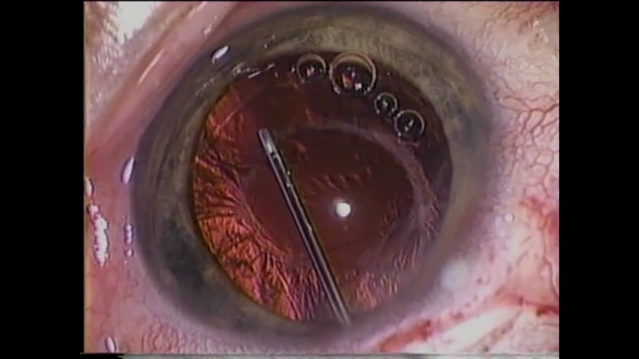 Late Re-Opening of the Bag