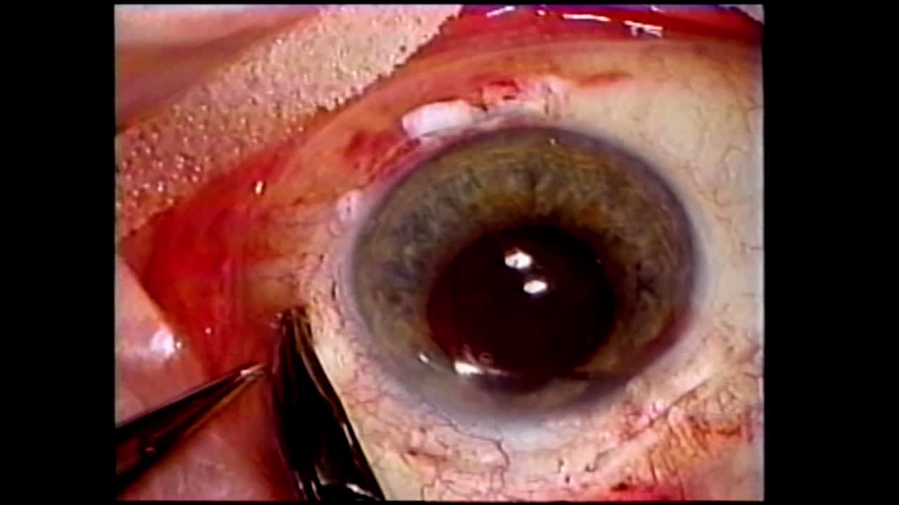 History Lesson:  The Lasso