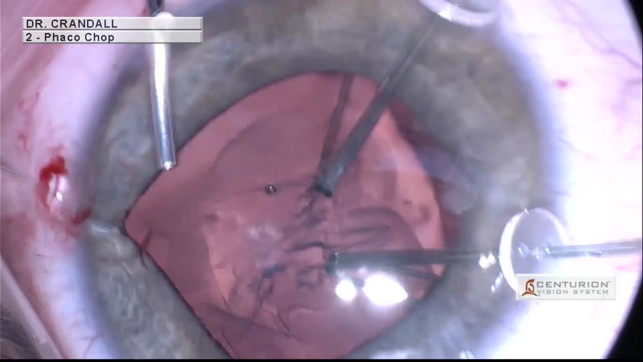 Ambati Device