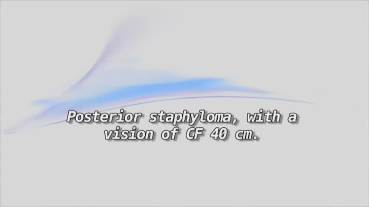 Thumbnail for vj583
