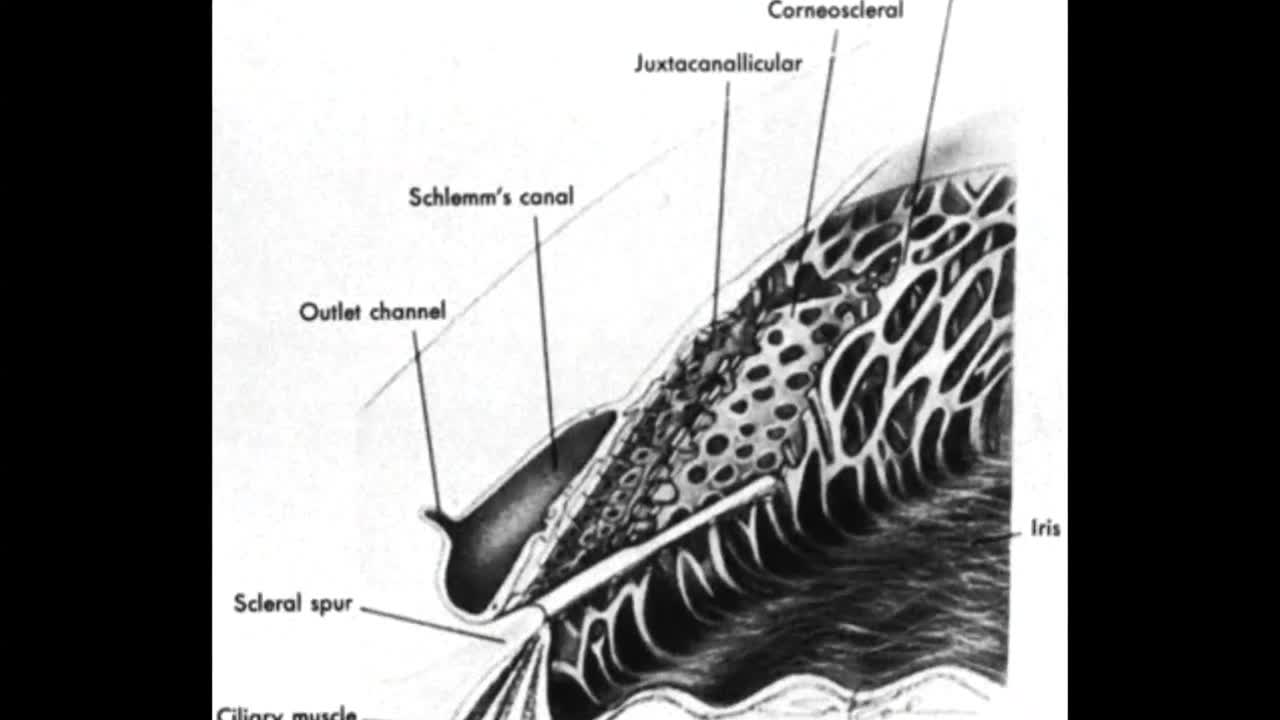Walking on the Moon: A MIGS Perspective For the Cataract Surgeon
