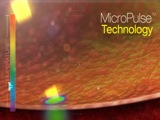 MicroPulse Laser Technology - Eyetube