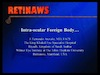 Intraocular Foreign Body