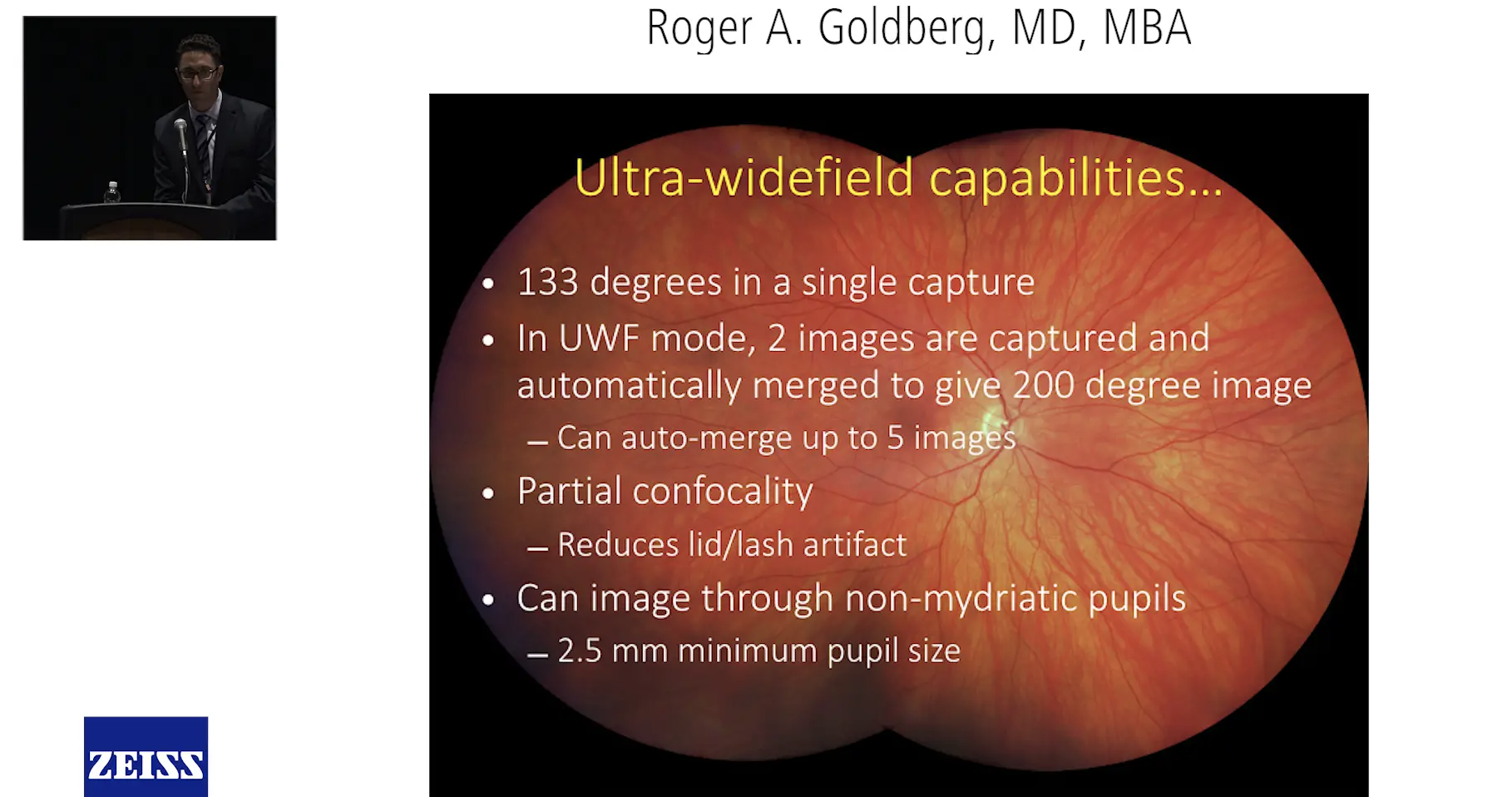Clarus 500 HD Ultra-widefield Imaging