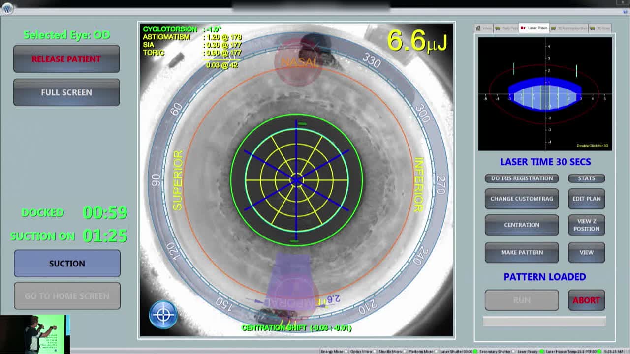 Time-Saving Benefits of LENSAR