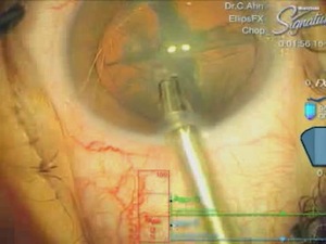 Nucleofractis! No Laser? No Problem!