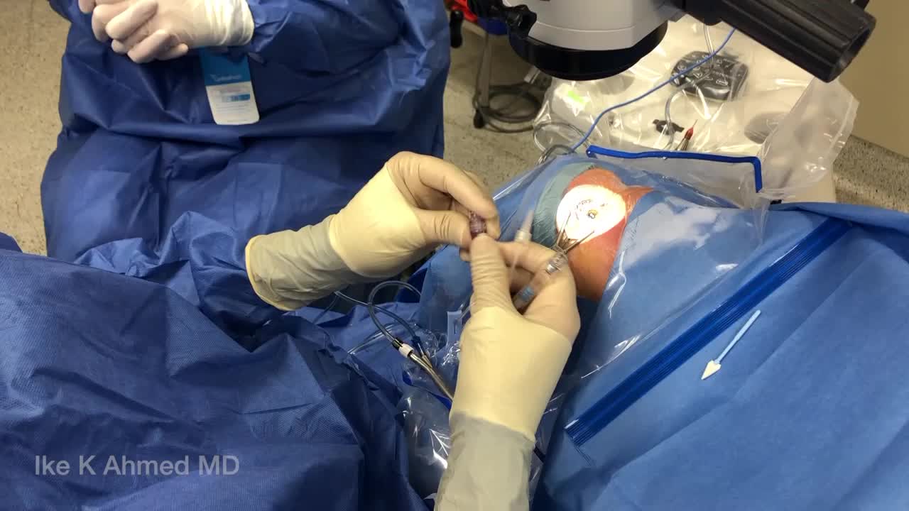 Air/OVD Xen Technique