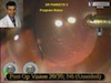 Piggyback Implantation of Toric and Multifocal IOLs: Exploring Uncharted Territory