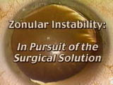Zonular Instability: The Evolution of a Surgical Solution