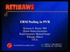 ERM Peeling in PVR