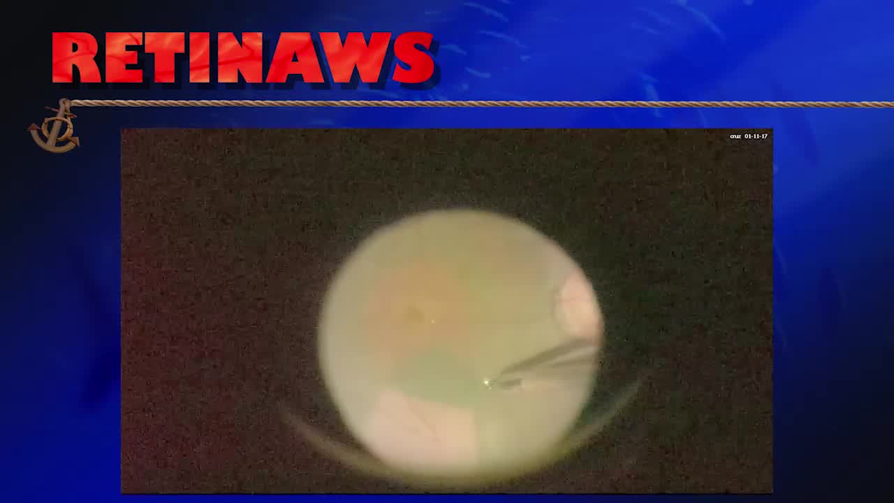 Thumbnail for wmkek