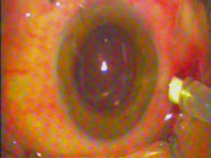 Thumbnail for womor