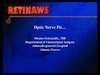 Optic Nerve Pit