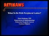What To Do With Peripheral Lattice?