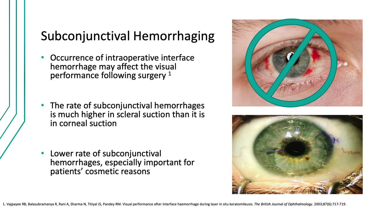 Driving New Levels of Physician and Patient Experience With LVC Options