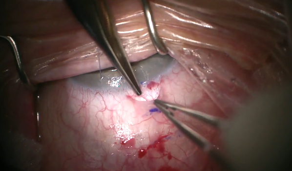 Xen External Cutdown Approach