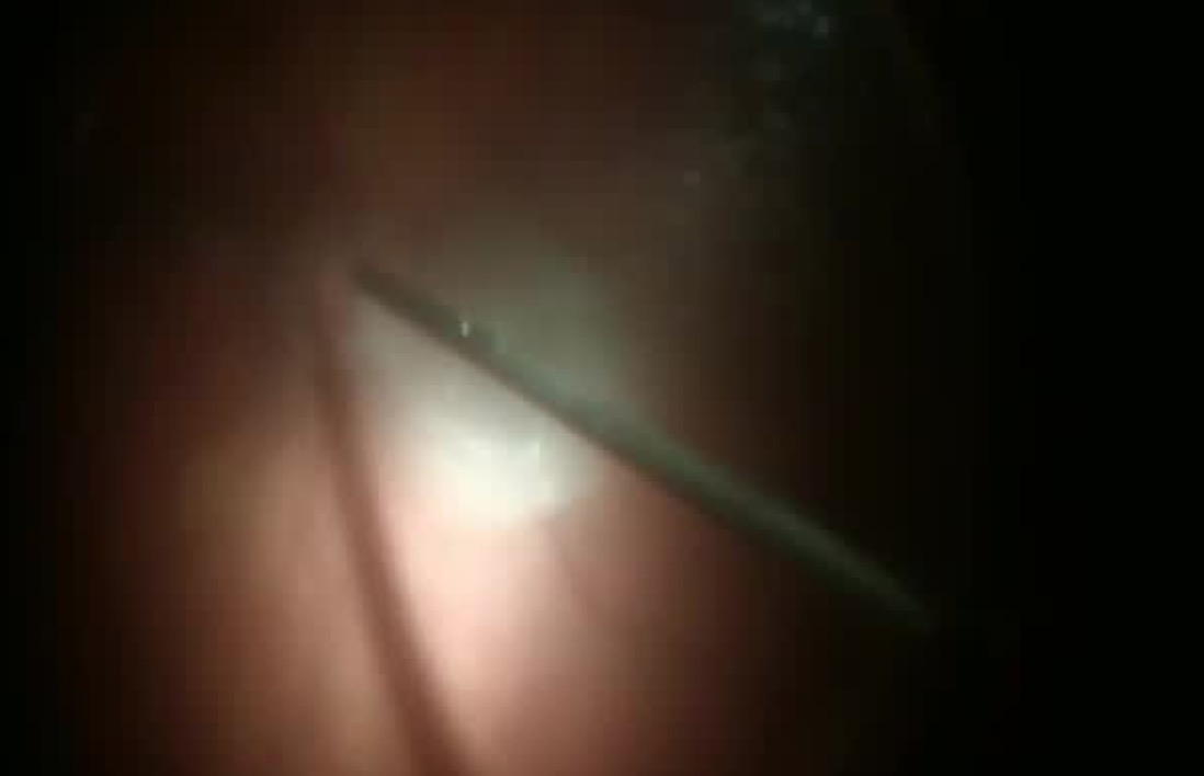3-D Phaco and Vitrectomy in Virtual Reality
