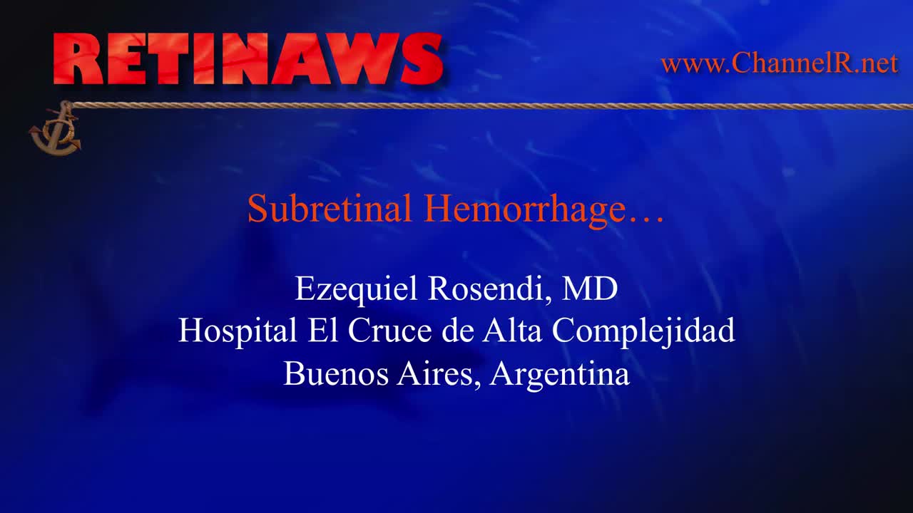 Subretinal Hemorrhage
