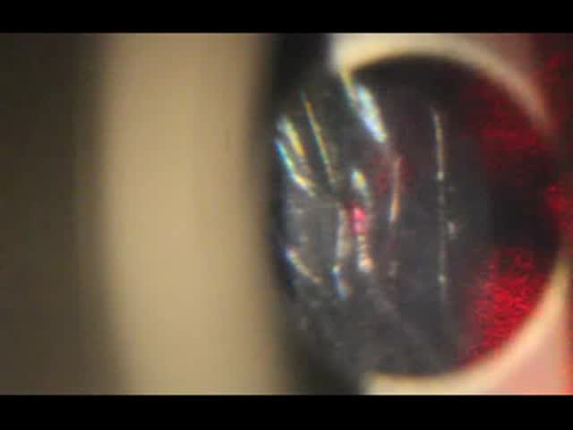 YAG through IC-8