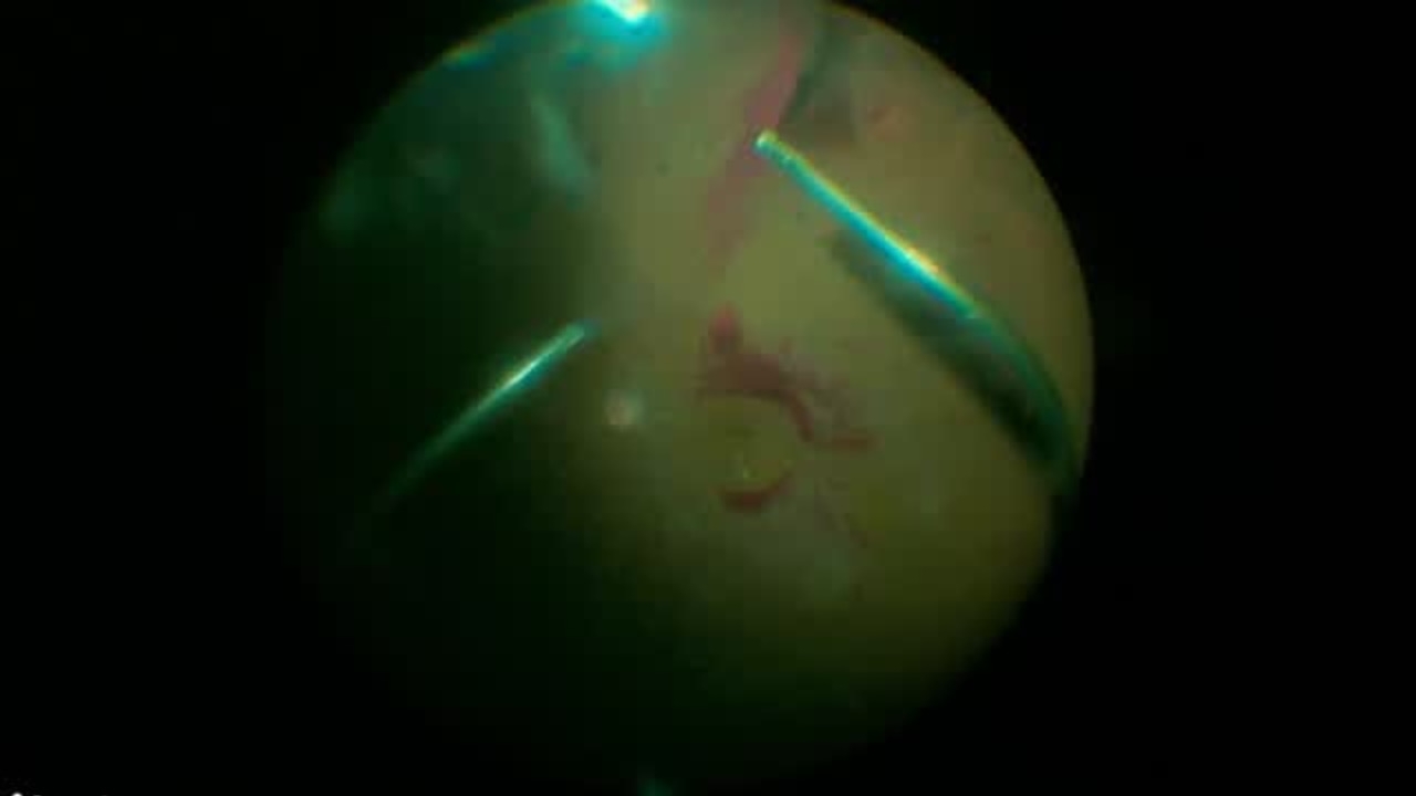 Adjusting Ngenuity Settings for Enhanced Visualization