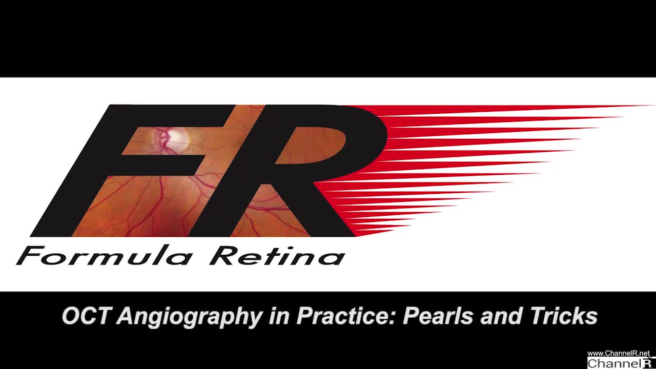 OCT Angiography in Practice: Pearls and Tricks