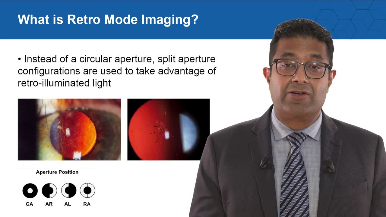 Retro Mode Imaging in a Multimodal Assessment of AMD and Macular Dystrophies