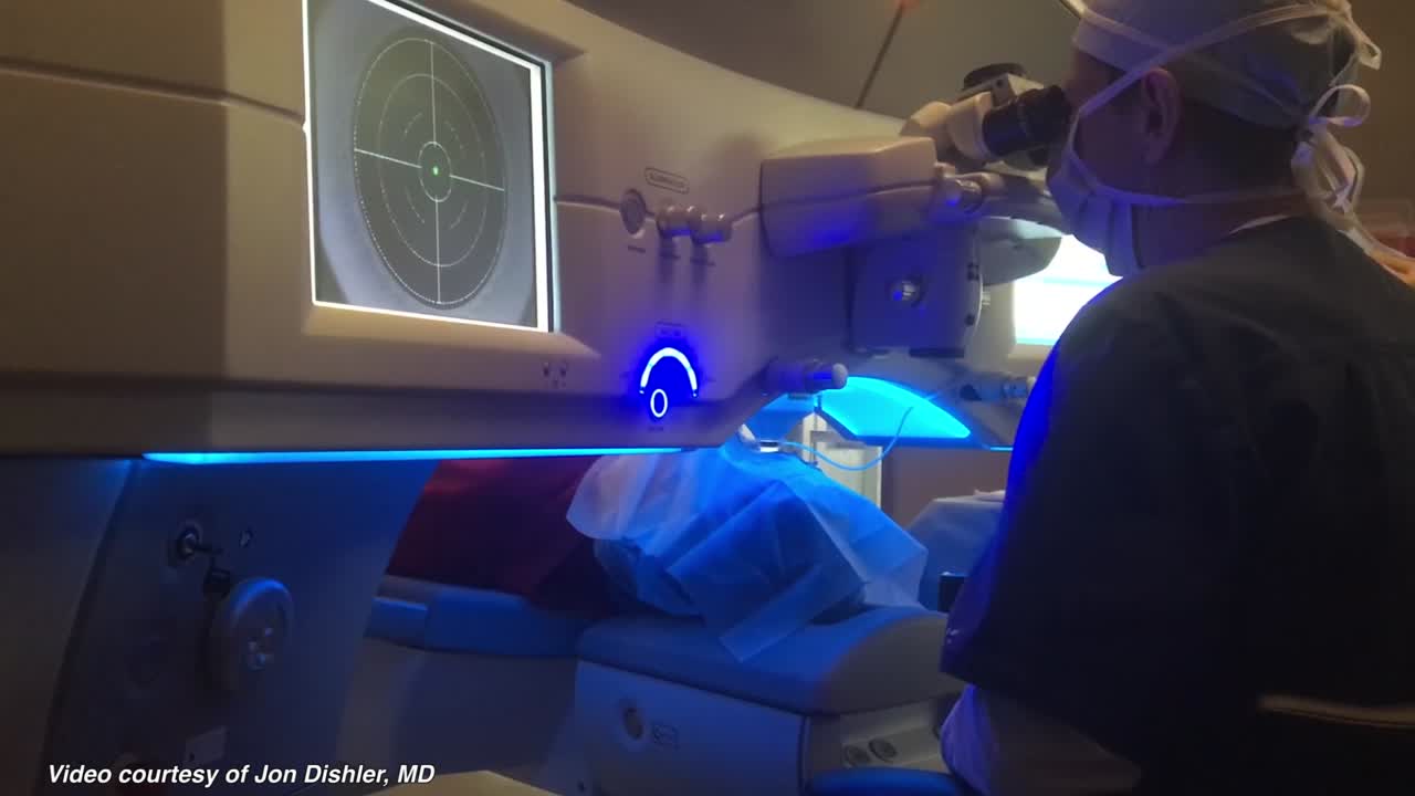 SMILE Procedure